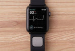 AliveCor gets FDA approval for detecting high blood potassium levels using ECG